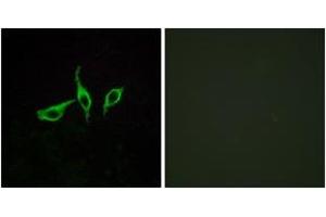 Immunofluorescence analysis of LOVO cells, using GPR120 Antibody. (O3FAR1 抗体  (AA 221-270))