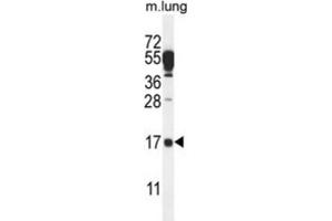 Western Blotting (WB) image for anti-Chromosome 14 Open Reading Frame 126 (C14orf126) antibody (ABIN2995710) (C14orf126 抗体)