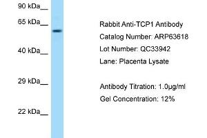 Western Blotting (WB) image for anti-T-Complex 1 (TCP1) (C-Term) antibody (ABIN2789568) (TCP1 alpha/CCTA 抗体  (C-Term))