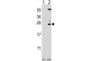 Western Blotting (WB) image for anti-Kallikrein 6 (KLK6) antibody (ABIN3002615)