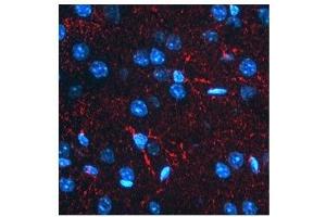 BACE1 antibody used at a concentration of 2-10 ug/ml to detect astrocytes in rodent brain (red). (BACE1 抗体  (N-Term))