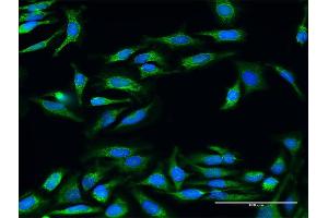 Immunofluorescence of purified MaxPab antibody to UQCRC2 on HeLa cell. (UQCRC2 抗体  (AA 1-453))