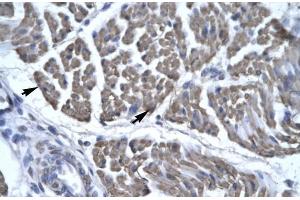Human Skeletal Muscle; EYA3 antibody - middle region in Human Skeletal Muscle cells using Immunohistochemistry (EYA3 抗体  (Middle Region))