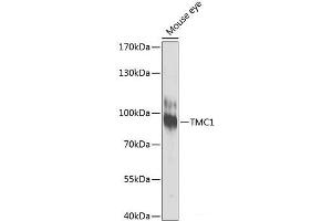Western blot analysis of extracts of Mouse eye using TMC1 Polyclonal Antibody at dilution of 1:1000.