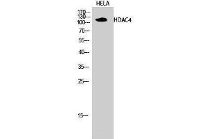 Western Blotting (WB) image for anti-Histone Deacetylase 4 (HDAC4) (Tyr493) antibody (ABIN3184987)