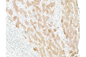 Immunohistochemistry (IHC) image for anti-C-Reactive Protein (CRP) antibody (ABIN7449481)