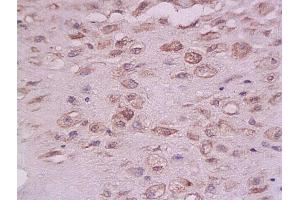 Immunohistochemistry (IHC) image for anti-Protein tyrosine Phosphatase, Non-Receptor Type 1 (PTPN1) (AA 1-100) antibody (ABIN725975)