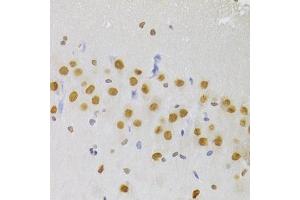 Immunohistochemistry of paraffin-embedded rat brain using HNRNPA1 Antibody (ABIN5975570) at dilution of 1/100 (40x lens). (HNRNPA1 抗体)