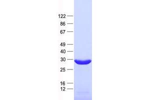 Western Blotting (WB) image for THAP Domain Containing 5 (THAP5) protein (His tag) (ABIN2733544)