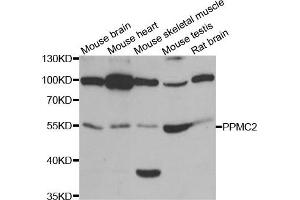 Western Blotting (WB) image for anti-Pyruvate Dehydrogenase Phosphatase (PDP) antibody (ABIN1980348) (PDP 抗体)