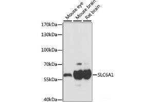 Western blot analysis of extracts of various cell lines using SLC6A1 Polyclonal Antibody at dilution of 1:1000. (SLC6A1 抗体)