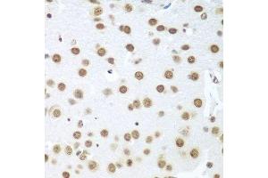 Immunohistochemistry (Paraffin-embedded Sections) (IHC (p)) image for anti-Breast Carcinoma Amplified Sequence 2 (BCAS2) (AA 1-225) antibody (ABIN6137479)