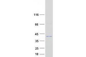 Western Blotting (WB) image for Epithelial Stromal Interaction 1 (Breast) (EPSTI1) (Transcript Variant 1) protein (Myc-DYKDDDDK Tag) (ABIN2720357)