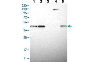 Western blot analysis of Lane 1: RT-4, Lane 2: U-251 MG, Lane 3: Human Plasma, Lane 4: Liver, Lane 5: Tonsil with TMED2 polyclonal antibody  at 1:250-1:500 dilution. (TMED2 抗体)