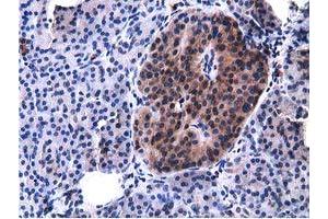 Immunohistochemical staining of paraffin-embedded Carcinoma of Human lung tissue using anti-VWA5A mouse monoclonal antibody. (VWA5A 抗体)