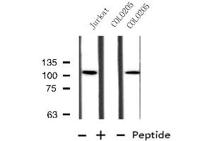 Western blot analysis of extracts from Jurkat/COLO205 cells, using MBTPS1 antibody. (MBTPS1 抗体  (Internal Region))