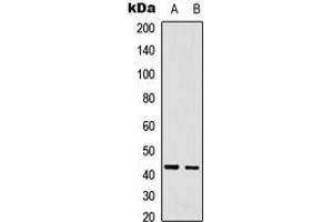 Western blot analysis of CDCA7 expression in A431 (A), U2OS (B) whole cell lysates. (CDCA7 抗体  (Center))