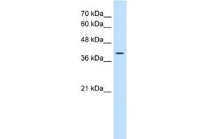 WB Suggested Anti-WNT2B Antibody Titration:  0. (WNT2B 抗体  (N-Term))