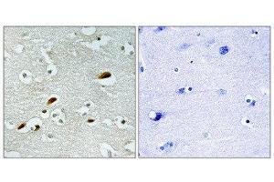 Immunohistochemistry (IHC) image for anti-K(lysine) Acetyltransferase 5 (KAT5) (Internal Region) antibody (ABIN1849869) (KAT5 抗体  (Internal Region))