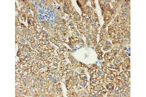 Anti-MTCO1 antibody, IHC(P): Mouse Liver Tissue (COX1 抗体  (C-Term))