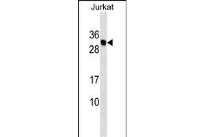 HLA-DMB Antibody (Center) (ABIN1537808 and ABIN2849547) western blot analysis in Jurkat cell line lysates (35 μg/lane). (HLA-DMB 抗体  (AA 127-154))