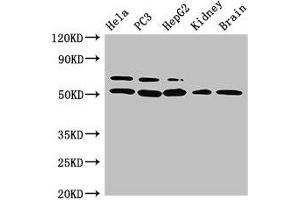 Western Blot Positive WB detected in: Hela whole cell lysate, PC-3 whole cell lysate, HepG2 whole cell lysate, Mouse kidney tissue, Mouse brain tissue All lanes: NR5A2 antibody at 3 μg/mL Secondary Goat polyclonal to rabbit IgG at 1/50000 dilution Predicted band size: 62, 57, 43, 54 kDa Observed band size: 62, 54 kDa (NR5A2 + LRH1 抗体  (AA 182-291))