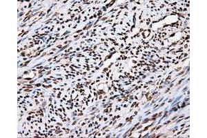 Immunohistochemical staining of paraffin-embedded Kidney tissue using anti-APP mouse monoclonal antibody. (APP 抗体)