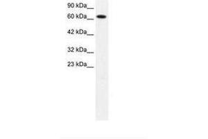 Image no. 2 for anti-Protein Inhibitor of Activated STAT, 3 (PIAS3) (AA 548-597) antibody (ABIN202823) (PIAS3 抗体  (AA 548-597))