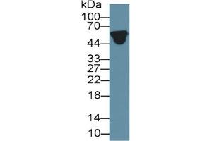 Rabbit Detection antibody from the kit in WB with Positive Control: Sample Human serum.