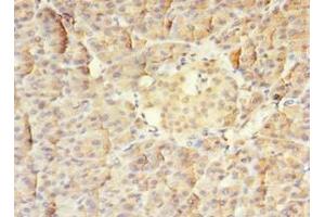 Immunohistochemistry of paraffin-embedded human pancreatic tissue using ABIN7159585 at dilution of 1:100 (MTR 抗体  (AA 923-1265))