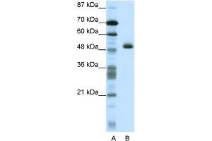 WB Suggested Anti-ZNF213 Antibody Titration:  1. (ZNF213 抗体  (N-Term))