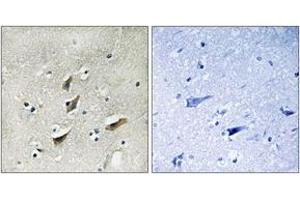Immunohistochemistry analysis of paraffin-embedded human brain tissue, using Dematin (Ab-403) Antibody. (Dematin 抗体  (AA 356-405))