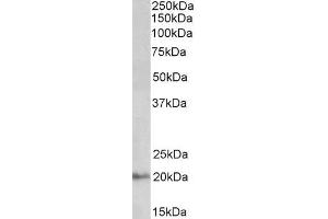 ABIN571258 (0. (DCTN3 抗体  (Internal Region))