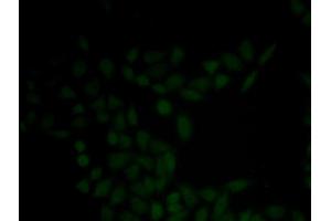Immunofluorescence analysis of HeLa cell using KRT5 antibody (Cytokeratin 5 抗体)