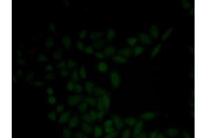 Immunofluorescence analysis of HeLa cell using KRT5 antibody (Cytokeratin 5 抗体)