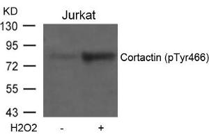 Western blot analysis of extracts from Jurkat cells untreated or treated with H2O2 using Cortactin(Phospho-Tyr466) Antibody. (Cortactin 抗体  (pTyr466))