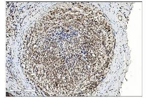IHC analysis of SUMO2/3 using anti-SUMO2/3 antibody (ABIN7600856). (SUMO2/3 抗体  (AA 24-72))