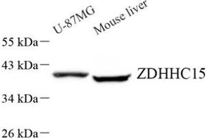 Western blot analysis of ZDHHC15 (ABIN7076280) at dilution of 1: 500 (ZDHHC15 抗体)