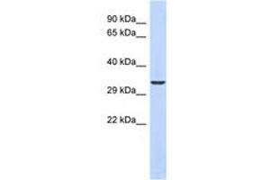 Image no. 1 for anti-Ventral Anterior Homeobox 1 (VAX1) (N-Term) antibody (ABIN6740506) (VAX1 抗体  (N-Term))