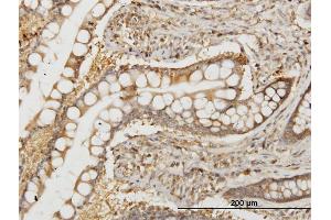 Immunoperoxidase of monoclonal antibody to NMI on formalin-fixed paraffin-embedded human small Intestine. (NMI 抗体  (AA 1-100))