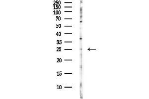 anti-Suppressor of Cytokine Signaling 3 (SOCS3) (C-Term) antibody