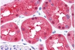 Human Kidney: Formalin-Fixed, Paraffin-Embedded (FFPE) (FAH 抗体  (N-Term))