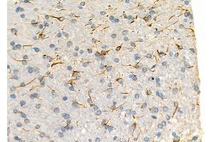 ABIN6266253 and ABIN6277443 at 1/100 staining Rat brain tissue by IHC-P. (MYSM1 抗体  (Internal Region))