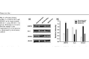 Rat brain lysates probed with Rabbit Anti-ORP150 Polyclonal Antibody (HYOU1 抗体  (AA 401-500))