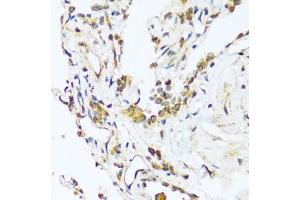 Immunohistochemistry of paraffin-embedded human lung using B antibody (ABIN7265851) at dilution of 1:100 (40x lens). (BAG3 抗体  (AA 380-575))