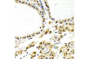 Immunohistochemistry of paraffin-embedded human thyroid using ATF2 antibody. (ATF2 抗体  (AA 1-190))