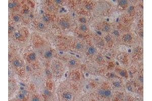 DAB staining on IHC-P; Samples: Human Liver Tissue (CENPE 抗体  (AA 2450-2590))