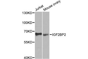Western blot analysis of extracts of various cell lines, using IGF2BP2 antibody (ABIN5971464) at 1/1000 dilution. (IGF2BP2 抗体)