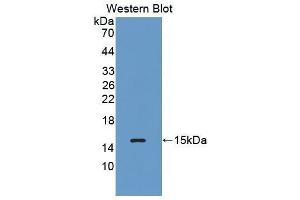Western Blotting (WB) image for anti-Complement Factor B (CFB) (AA 476-592) antibody (ABIN3205630) (Complement Factor B 抗体  (AA 476-592))