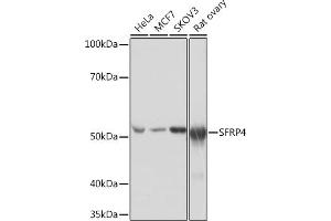 Western blot analysis of extracts of various cell lines, using SFRP4 Rabbit mAb (ABIN7270180) at 1:1000 dilution. (SFRP4 抗体)